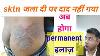 Fungal Infection Permanent Treatment I Daad Ka Ilaj L Dr Anil Mohite M D